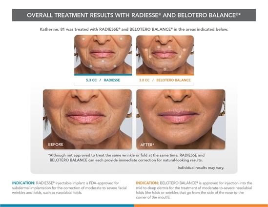 Lower Face Before and After