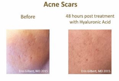 Aging Skin and Face Before and After