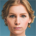 Facial Rejuvenation NYC | Wrinkle Reduction 