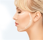 Facial Rejuvenation NYC | Facial Fillers